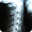 image of x rays